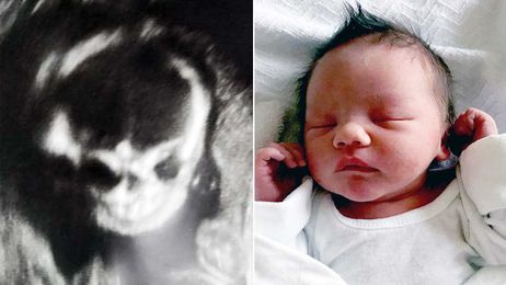 Pregnant Mom 'Freaked Out' When Ultrasound Showed a Skeleton in Her Belly