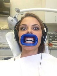 5 Facts About Teeth Whitening You Should Know