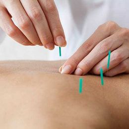Can acupuncture ease your chronic pain?