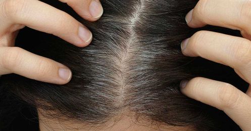 Stress Really Does Make You Go Gray!