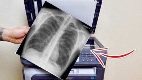What Happens if You Photocopy X-Ray