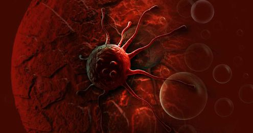 What are the causes of cancer?