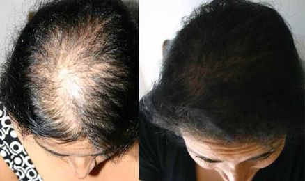 The hidden signs your hair is about to start falling out