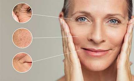 Fine Lines: Causes, Prevention, & Treatments