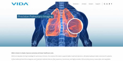 Vida Diagnostics raises $11 million to diagnose lung diseases with AI