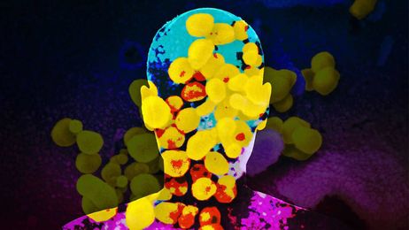 What an infectious disease specialist learned about the virus — from getting it