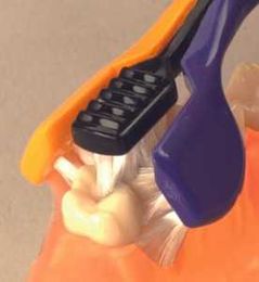DoorStep Dental Hygiene Blog