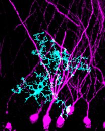 To Let Neurons Talk, Immune Cells Clear Paths Through Brain’s ‘Scaffolding’