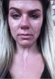 12 More Common Spray Tan Problems And How To Fix Them!
