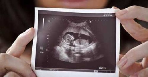 Abortions Don’t “Remove” the “Productions of Conception.” They Kill Babies