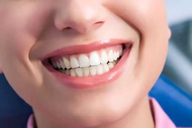 Post-Procedure Instructions for Teeth Whitening