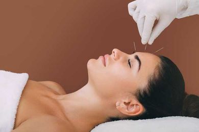 Does Acupuncture Really Work?