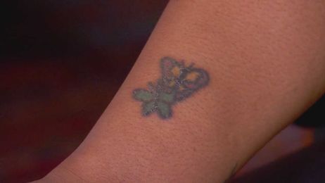 Could your tattoo blind you? The link between ink and a rare eye condition