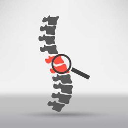 5 Questions To Ask Your Surgeon Before Spine Surgery