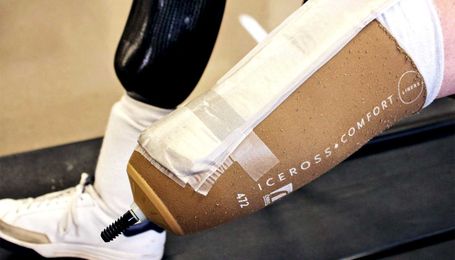 Sensor patch tracks pressure points in prosthetic limbs