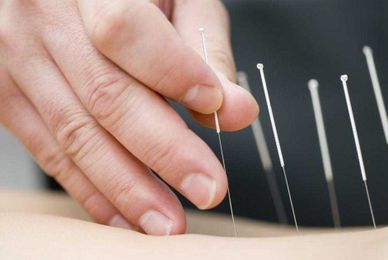 Savvy Senior: Exploring if acupuncture works, if it is covered by Medicare