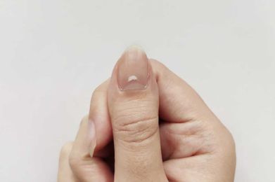 Here’s What It Means if You Have White Spots on Your Nails