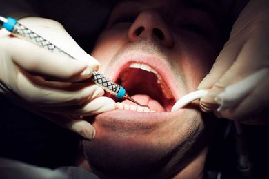 Apparently Dentists Can Tell If You've Been Giving Head