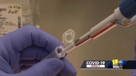 Technology developed in Maryland could predict COVID-19 symptom severity