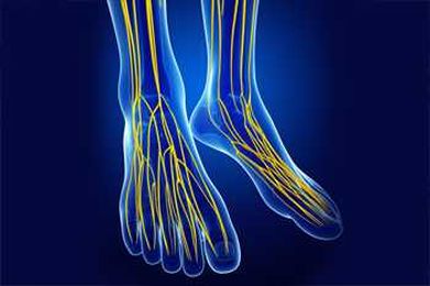 What Are the Symptoms of Charcot Foot?