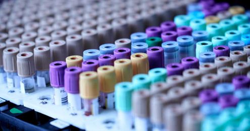 Helper T-cells Drive Transition from RRMS to SPMS, Study Suggests