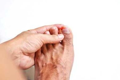 Don’t Touch That Ingrown Toenail! — Podiatry Group of Annapolis, P.A.