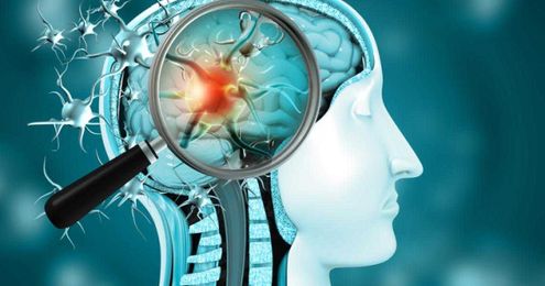 New advanced PET approach helps surgeons stop epileptic seizures