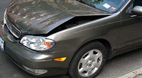 Things Every Car Owner Must Know About Car Dents