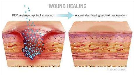 Preclinical discovery triggers wound healing, skin regeneration