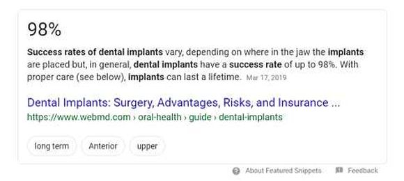 Dental Implant FAQs: 7 Answers to Questions People Ask Most