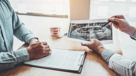 Dental Implants: Everything You Need To Know