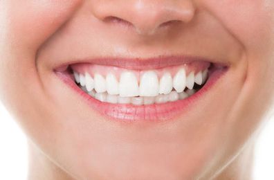 Make Your Smile Healthier With Sparkling White Teeth |