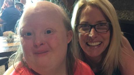 Opinion: Looking at disability differently