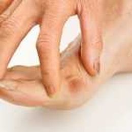 Is There Relief for Bunions?