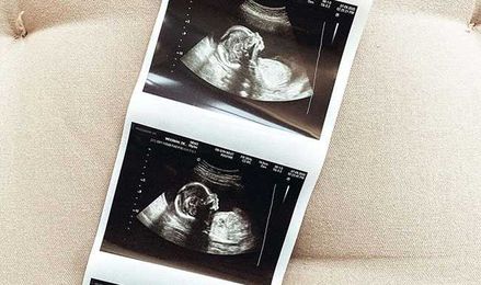 How Your Blood Type Can Affect Your Pregnancy