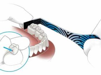 If the Crown Doesn’t Fit, Adjust it