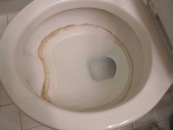 Why You Shouldn't Use Drano in Toilets