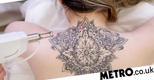 The science behind laser tattoo removal: how long it takes and side effects
