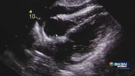 Group looks at how female veterans may be more at risk for heart disease