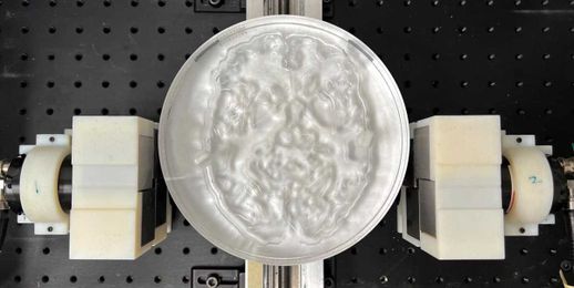 Researchers Take the Guesswork Out of PET Imaging