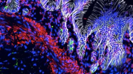 Most-Advanced Lab-Grown Mini-Stomachs Now Churns Out Acid