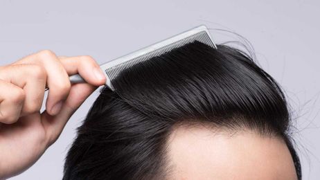 Everything You Shouldn’t Do to Your Hair During the Winter