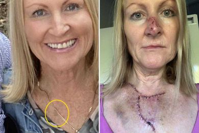 I went for a facial to relax but left fearing for my life