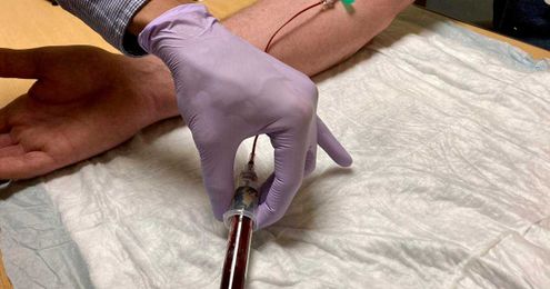 Your Cancer Answers: There are two main types of esophageal cancer