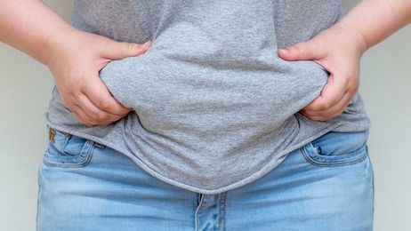 Obesity: What is it, and what causes it?
