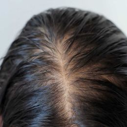 The One Common Hair Care Mistake Hair Stylists Are Begging People To Stop Making--It Causes Thinning Hair!